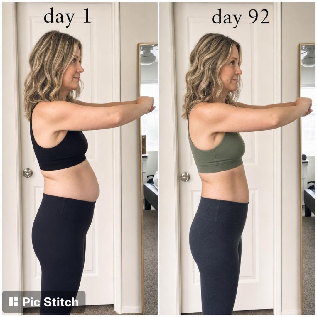 Marcy's day 1 and day 92 side-profile progress collage